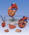 Heart Anatomy with Esophagus and Trachea, 2 times life size, 5 part model